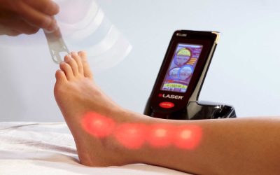 laser-terapia
